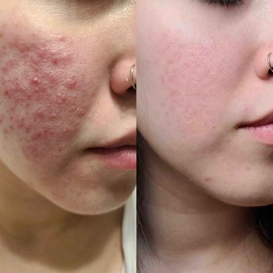 Testimoni Hero K-Colly